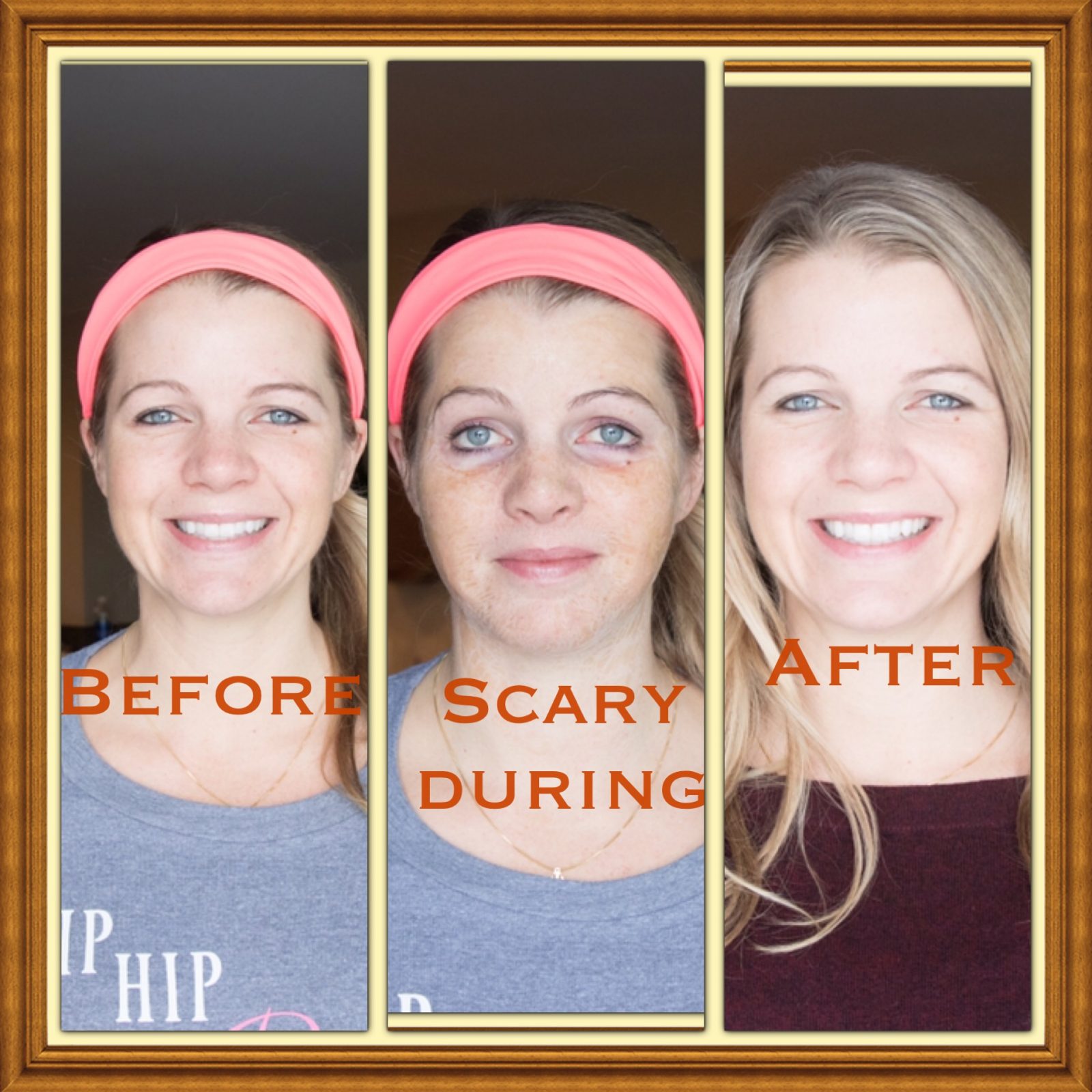 Hanacure AllInOne Facial allmomdoes